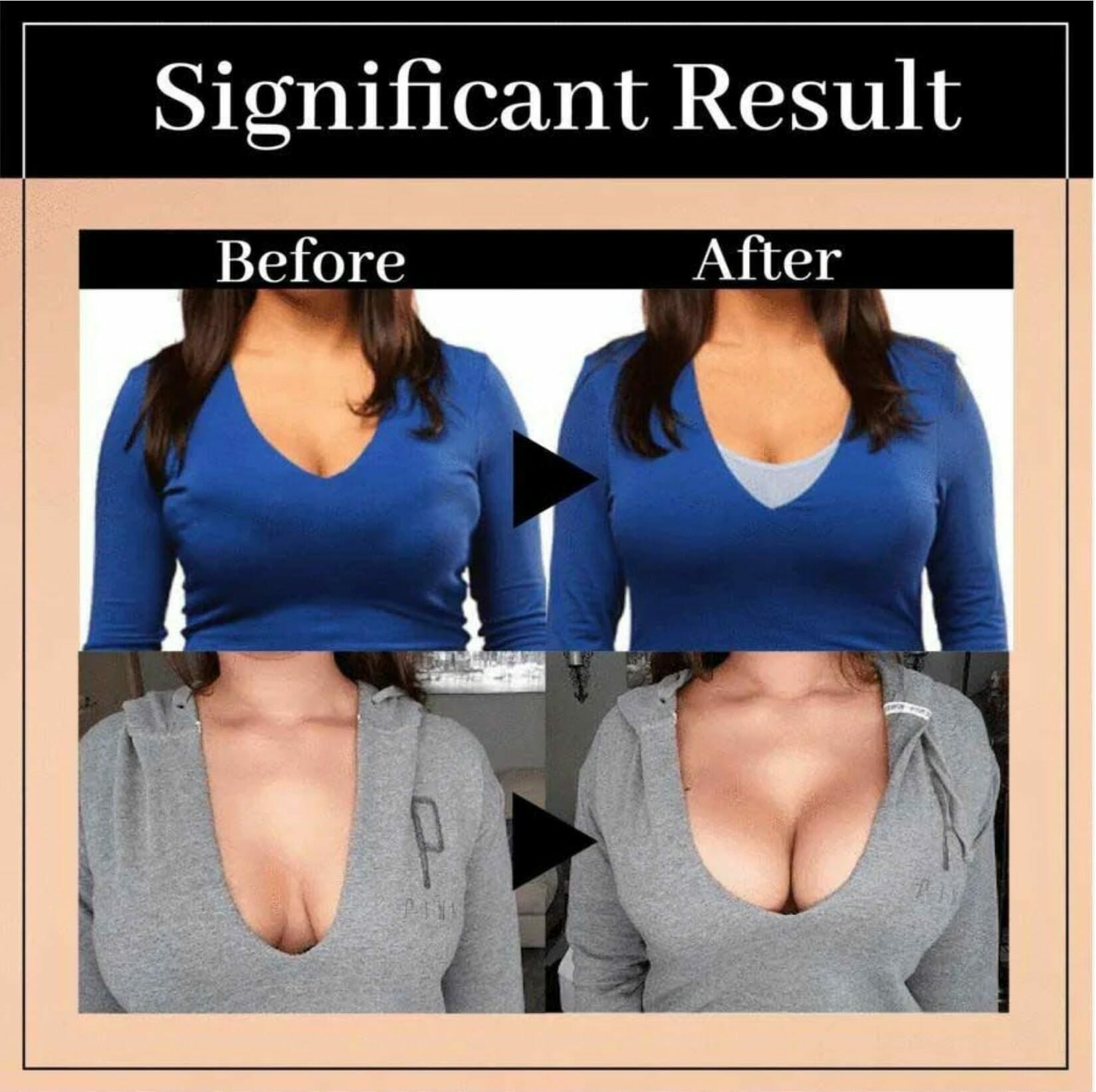 Posture Support Corrector Support Boost Bra Front Closure Bra Plus Size For Women - Image 14